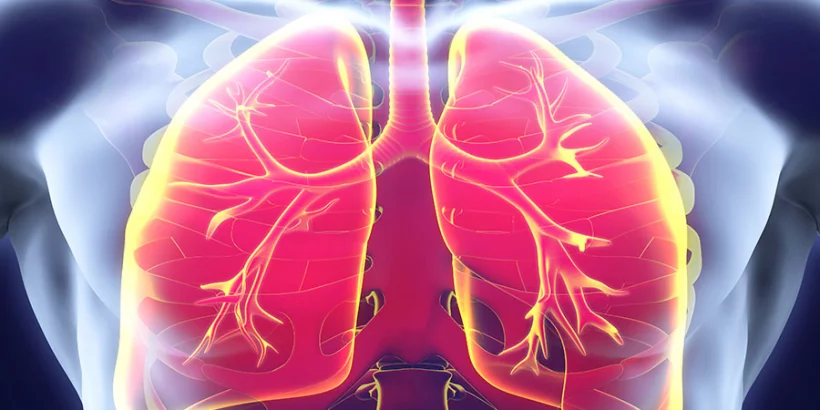 Mi a tüdőfibrózis?