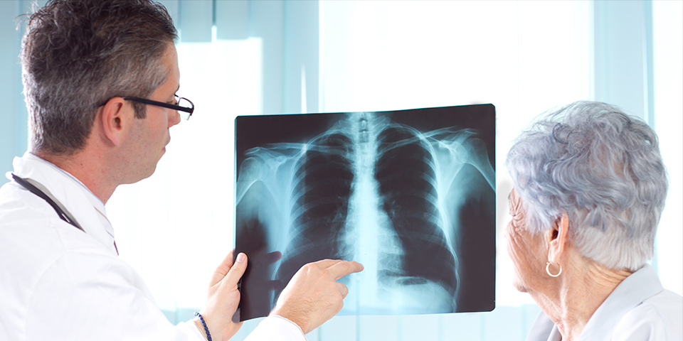 fogyás mellkas röntgen lupus hogyan lehet fogyni
