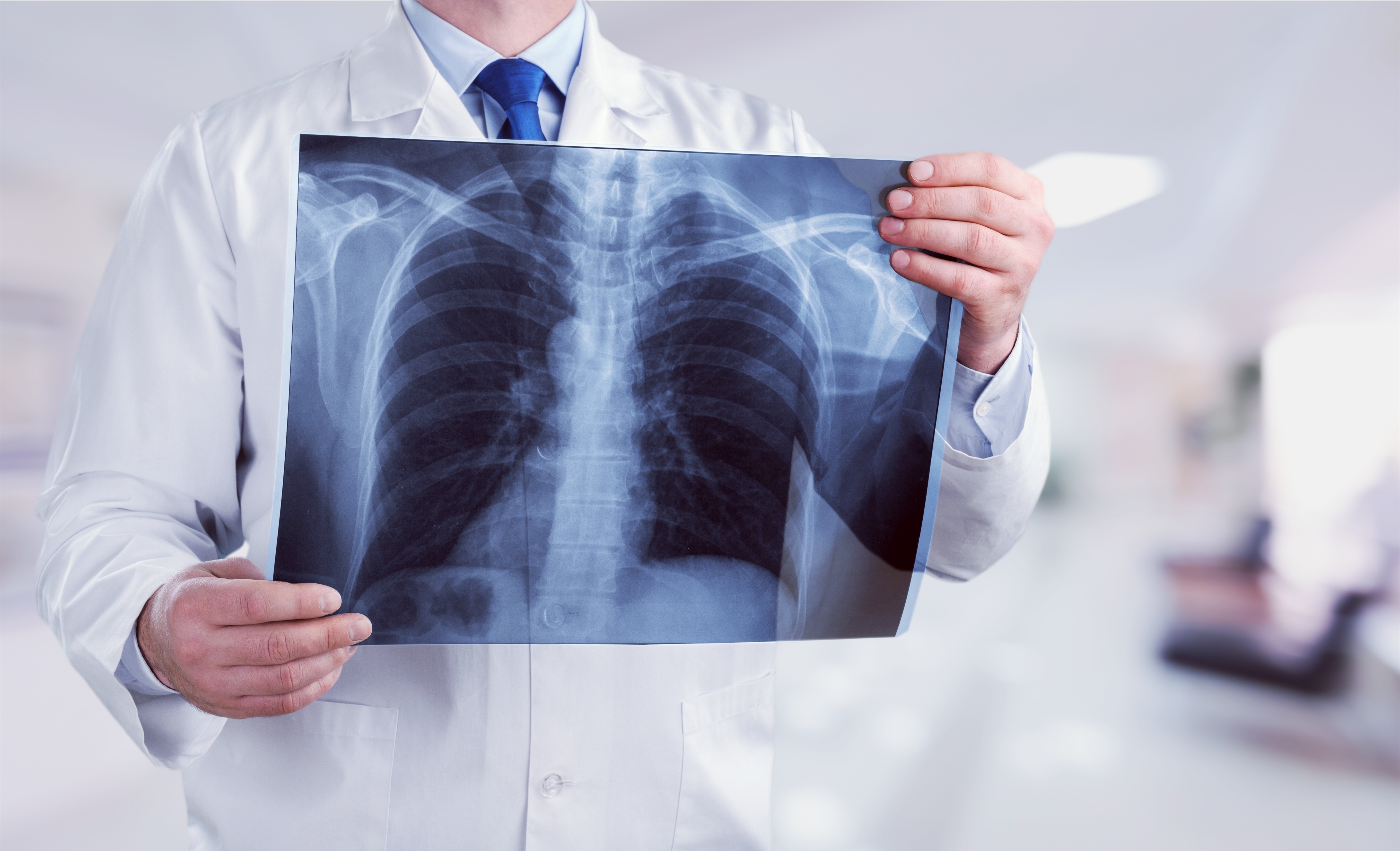 csont- és ízületi betegségek tüdőgyulladás után ízületi fájdalom képek