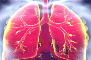 Mi a tüdőfibrózis?