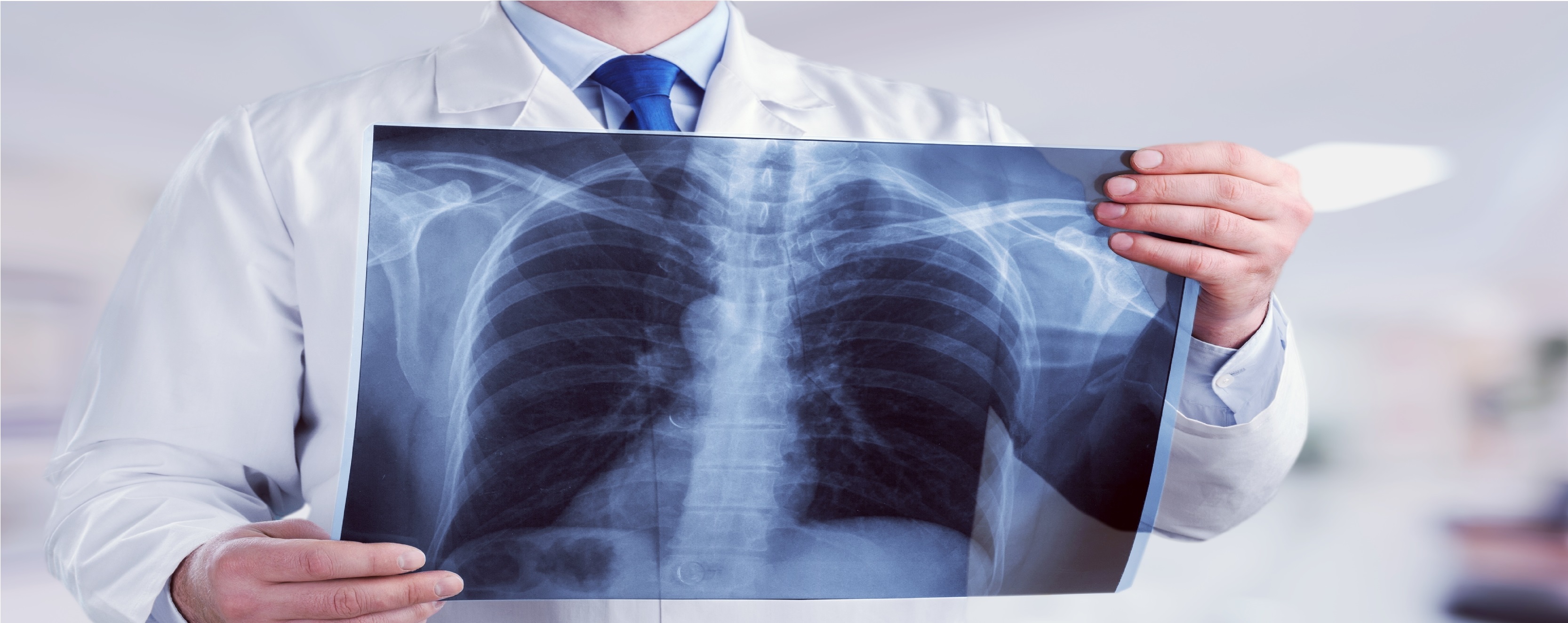 pneumonia kezelés cukorbetegséggel 2