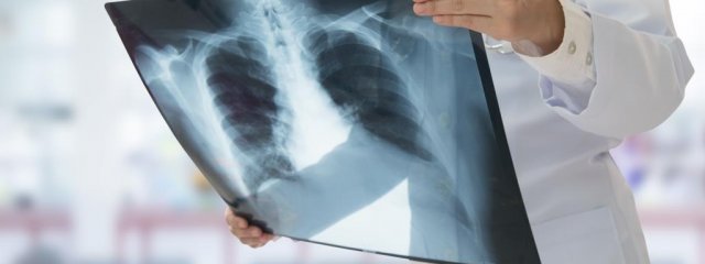 Tüdőgyulladás: influenza szövődménye is lehet