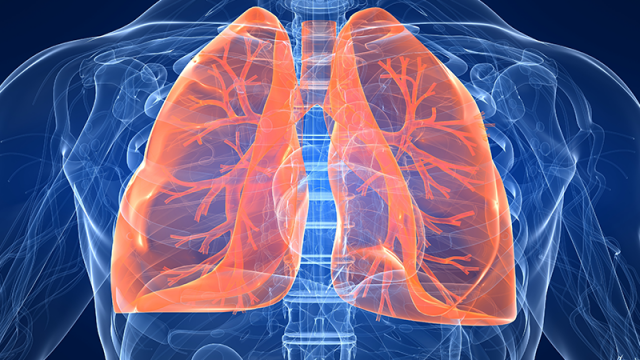 2020-ra a 3. leggyakoribb halálok lehet, pedig egyszerű vizsgálattal szűrhető a COPD