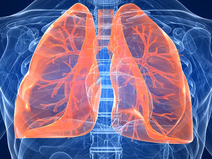 2020-ra a 3. leggyakoribb halálok lehet, pedig egyszerű vizsgálattal szűrhető a COPD