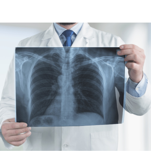 COPD megelőzése