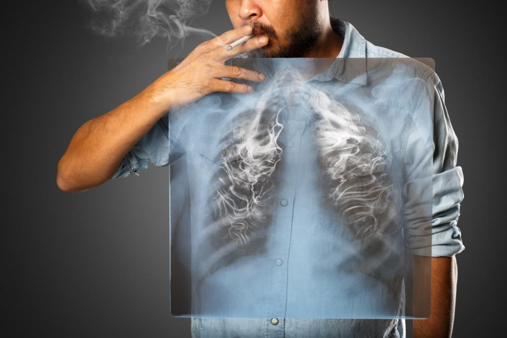 Hörghurut (bronchitis)
