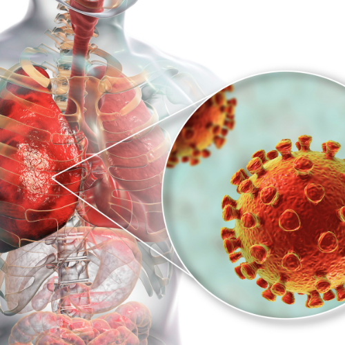 Tüdőgyulladás láz nélkül is jelentkezhet